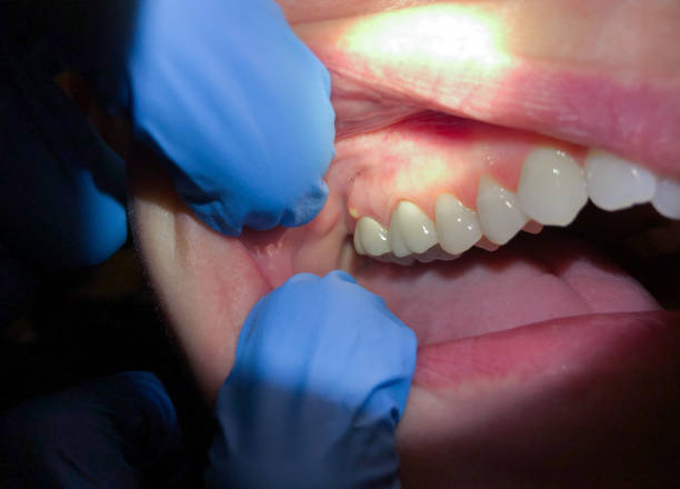 Best Pediatric Emergency Dentist in North Barrington, IL